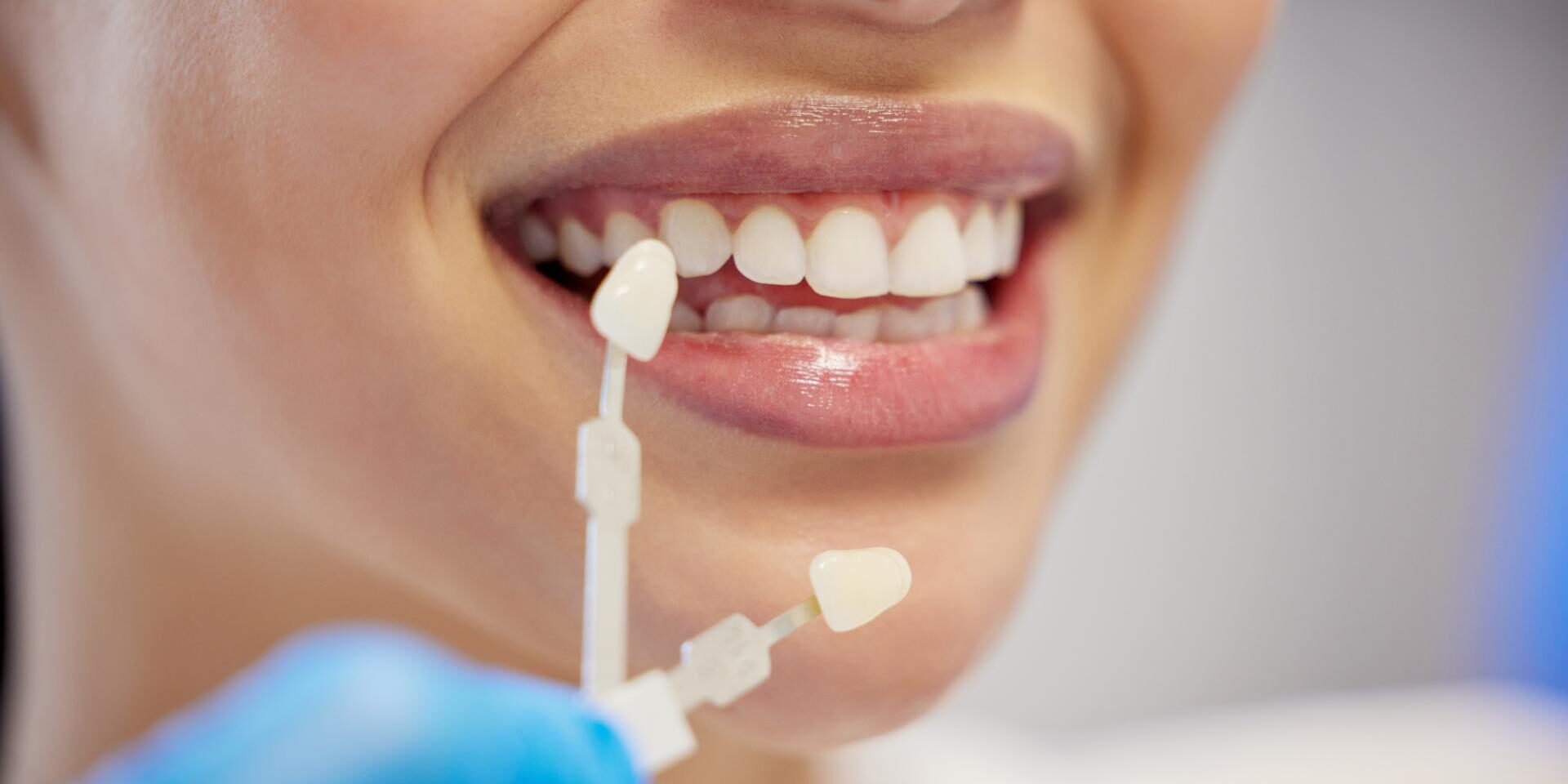 shot-of-an-unrecognisable-woman-having-her-teeth-c-2025-04-06-01-11-09-utc